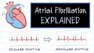 What is Atrial Fibrillation [upl. by Peer]