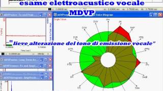 CORDECTOMIA RIABILITAZIONE [upl. by Sivle88]