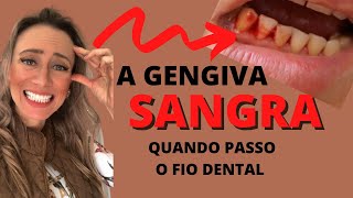 Quando passo fio dental minha gengiva sangra😰 DEVO PASSAR mesmo assim [upl. by Shapiro]