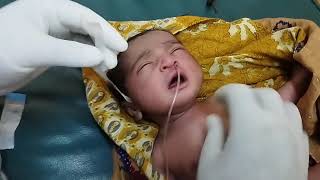 Nasogastric NGTube Insertion Suctioning NeonateNewbornOrogastricOGTube Feeding TubePaediatric [upl. by Ovida]