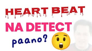 Heart Beat nadetect Paano [upl. by Aicilyt]