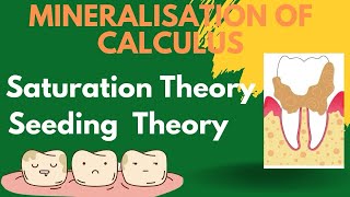 Theories of mineralisation of calculus  Periodontology [upl. by Giglio]