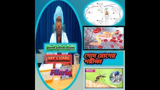 ফাইলেরিয়া টেস্ট গোদ রোগের জন্য করানো হয় Filaria Filariasis Test In Bangla [upl. by Missak]