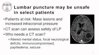 3 Bacterial Meningitis Diagnosis and Common Pathogens [upl. by Ynnelg]