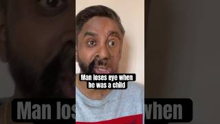 Man opens up about losing his eye when he was a child [upl. by Arba]