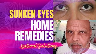 Natural Solutions for Sunken Eyes Easy Home Remedies [upl. by Enyalb]