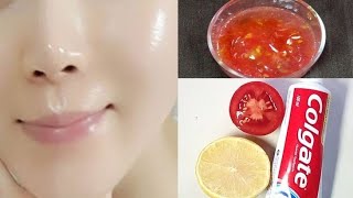 toothpaste and tomato for skin whiteningtomato facial at home for clear and glowing skin skincare [upl. by Ahsienet]