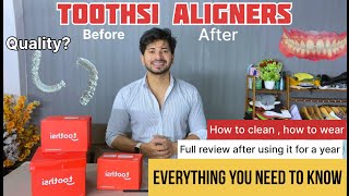 Toothsi Aligners Review And Unboxing 1 year experience  Everthing you need to know 1 [upl. by Grati410]