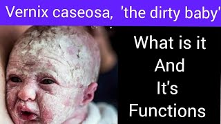 Whats vernix caseosa what is its benefits [upl. by Avner]