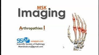 Imaging of polyarthropathies I DRE Prof Mamdouh Mahfouz [upl. by Liakim343]