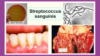 Streptococcus sanguinis [upl. by Arraic]