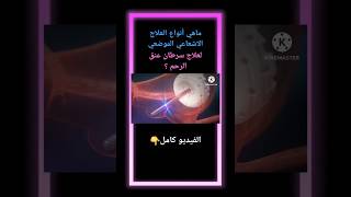 أنواع العلاج الاشعاعي الموضعي لعباج سرطان عنق الرحم🎗 سرطانعنقالرحم العلاجالاشعاعي صحة [upl. by Yeung703]