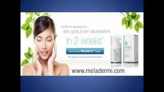 Meladerm Cream Reviews  My Experience Facts On Meladerm [upl. by Rai]