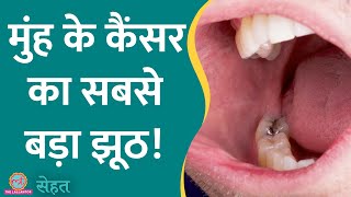 Oral Cancer यानी मुंह का कैंसर सिर्फ़ तंबाकू खाने वालों को होता है  Sehat ep 561 [upl. by Tserof32]