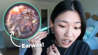 We Used An Earwax Cleaning Camera For The First Time [upl. by Eiramannod]