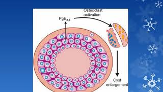 ODONTOGENIC CYSTS PART 1 Oral Pathology  3rd BDS [upl. by Dunn]