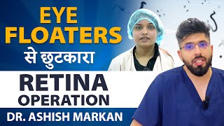 Eye Floater Treatment with Laser [upl. by Lithea385]