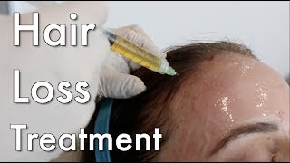 Hair Loss Treatment PRP [upl. by Cardwell305]