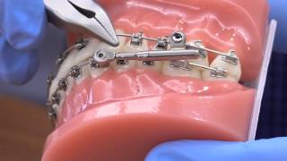 American Orthodontics PowerScope Activation [upl. by Nhojleahcim801]