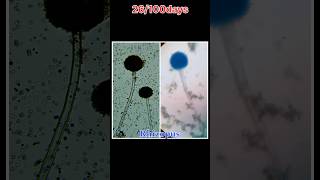 Rhizopus bacteria sudhanshuvlogs shorts minivlog dailyvlog [upl. by Vento]