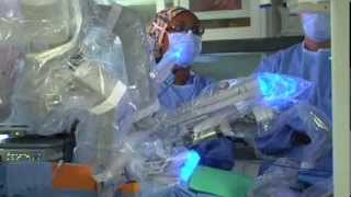 BreakthroughsRobotic Assisted Surgery at Moffitt Cancer Center [upl. by Hgieleak]