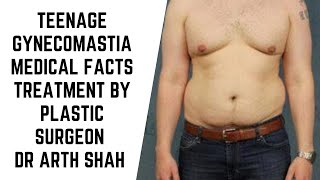 Teenage Gynecomastia Medical facts and Treatment options explained by Plastic Surgeon Dr Arth Shah [upl. by Vilberg]