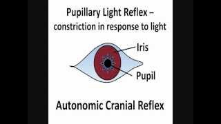 Pupillary Light Reflex  Cranial Nerves II amp III [upl. by Aramenta]