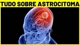 ASTROCITOMA  O que é TIPOS CAUSAS SINTOMAS E TRATAMENTO  Tumor cerebral [upl. by Vivie]