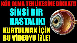 GÖZLERİ KÖR EDEBİLEN GİZLİ HASTALIK – GÖZ TANSİYONU VE KURTULMAK İÇİN YAPABİLECEĞİN DOĞAL TEDAVİLER [upl. by Katey]