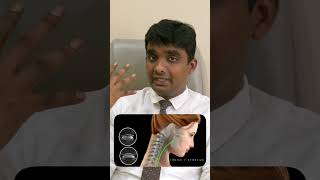 C56 C67 disc bulge in mri Cervical spondylosis என்ன சிகிச்சை செய்யலாம்  Dr Vijayaraghvan Shorts 3 [upl. by Atekin]