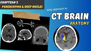 CT BRAIN Chapter 3 Parenchyma Internal capsule amp Deep Brain Nuclei Basal ganglia amp Thalamus [upl. by Landbert244]