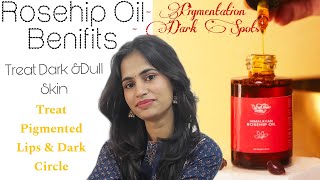 Vrikshveda Rosehip Oil Benifits  Uses Review  🤩 [upl. by Ecinej]