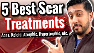 5 BEST Products for Scars  How to Get RID of Scars All Types [upl. by Salsbury760]