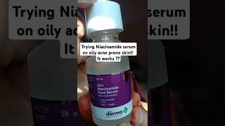 Best niacinamide serum for oily acne prone skin beginners niacinamide serum review youtubeshorts [upl. by Ardnoek]