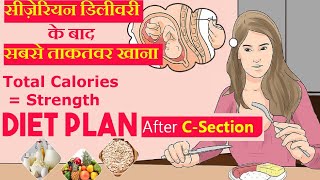 सिजेरियन डिलीवरी के बाद क्या खाये और क्या खाने से बचे  Diet Food After Cesarean Delivery [upl. by Falcone863]