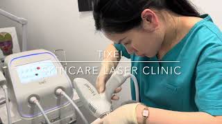 TIXEL  SKINCARE LASER CLINIC  POINT COOK MELBOURNE [upl. by Zondra524]