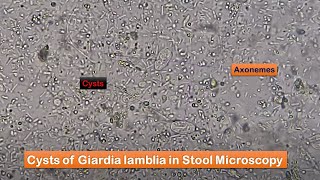 Giardia Cysts in stool Microscopy [upl. by Fraase61]