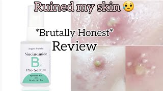 Organic traveller quotNiacinamidequot serum review ruined my skin 😥 [upl. by Reinal]