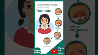 Chlamidiae and its serotypes  Microbio in 1 minute [upl. by Eecal]