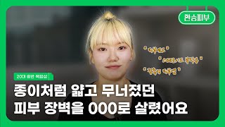 종이처럼 얇고 무너져버린 피부장벽을 피부과 안가고 되살린 홈케어 꿀팁💚접촉성피부염😰 스테로이드 연고 오남용😧 리바운딩현상😔 [upl. by Ramona261]