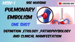 Pulmonary Embolism  part1 Bsc nursing semIII [upl. by Herahab126]