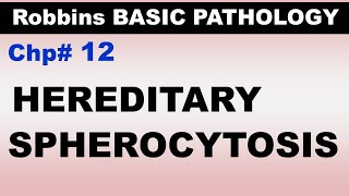 Ch12  Hereditary Spherocytosis  Hemolytic Anemia  Blood Pathology  Dr Asif Lectures [upl. by Lerad]