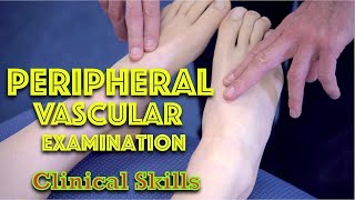 Peripheral Vascular Examination  Clinical Skills  Dr Gill [upl. by Aihsitan]