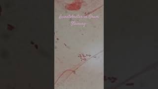 Gram negative bacteria in Gram Staining [upl. by Yentruoc]