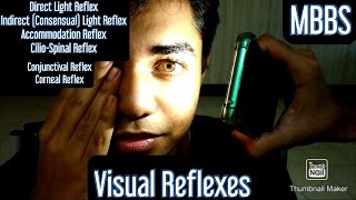 Visual Reflexes Direct Light Reflex Indirect Consensual Light Reflex Accommodation Reflex mbbs [upl. by Maggy]