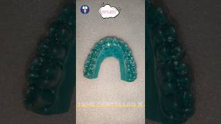 Hard Splint  Upper Arch  Invisible Retainer  Dentist World  Tamil Dental Lab  toothsi dentist [upl. by Anitnoc840]