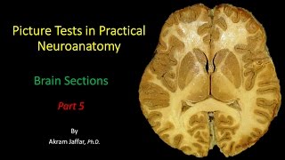 Picture Test in Neuroanatomy Brain Sections 5 [upl. by Laniger]