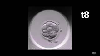 MIRI® TL  TimeLapse Annotation of an Embryo  Esco Medical [upl. by Bogie]