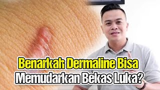 BENARKAH DERMALINE BISA MEMUDARKAN BEKAS LUKA❓MEMUDARKAN BEKAS LUKA [upl. by Roselle]