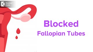 Blocked Fallopian Tubes Symptoms Fertility Issues amp Treatment  Dr Jyothi Patil  Doctors Circle [upl. by Ehrsam718]